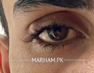 EYE Specialist 