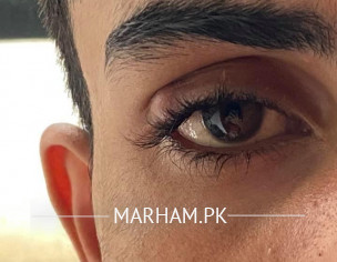 EYE Specialist 