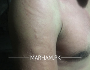 Skin Rashes 