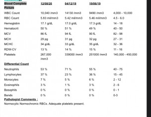 Crp Test And Cbc