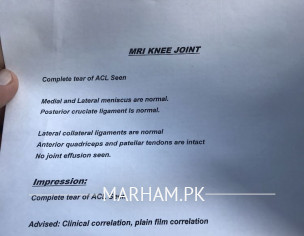 ACL Knee Joint
