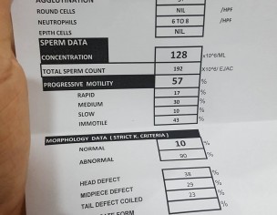 Semen Analysis