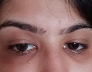  Face Skin   Prob