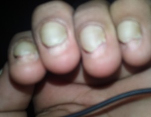 NAILS