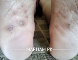 Skin Problem