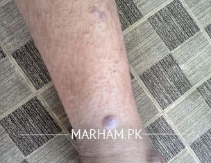 Skin Problem