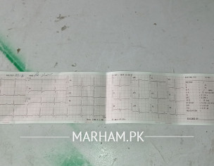 Ecg