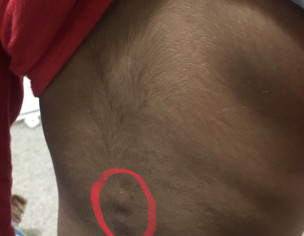 Itching On Spine