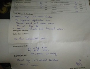 Echo Ecg