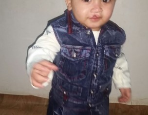 CLEFT LIP