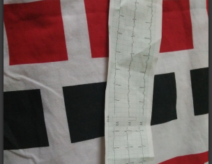 Ecg Report