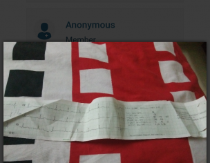 Ecg Report