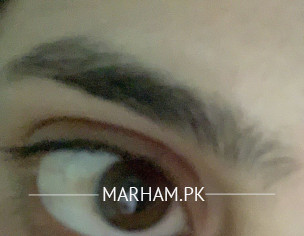 Eye Problems 