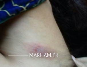 Skin Problem