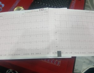 Ecg