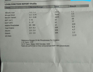 LFT Test ...
