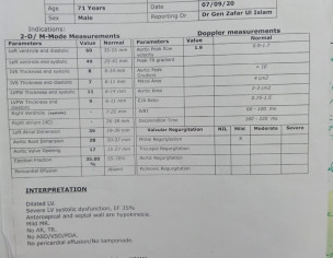 Memory Loss, Vision Problem Etc