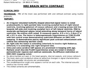 Memory Loss, Vision Problem Etc