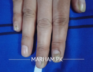 Skin Problem