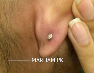 Second Ear Piercing
