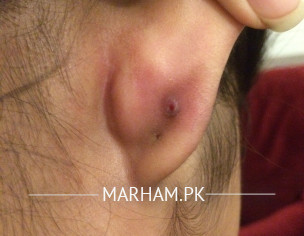 Second Ear Piercing