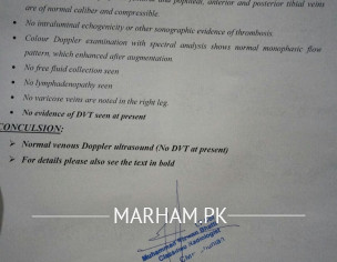 Dvt Issue