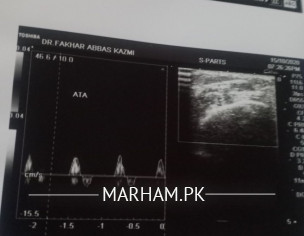 Vascular Diease