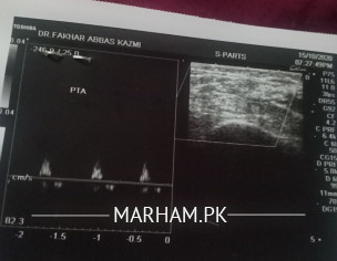 Vascular Diease