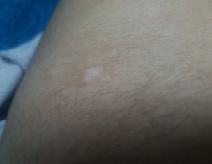 White Mark