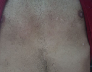 White Spots And Lines