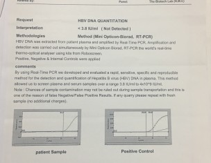 Hepatitis B