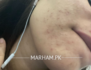 Dermatologist 