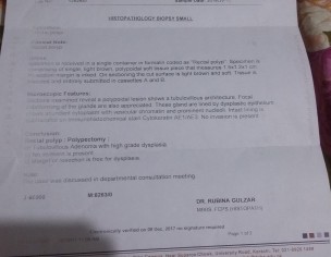 Colonoscopy 