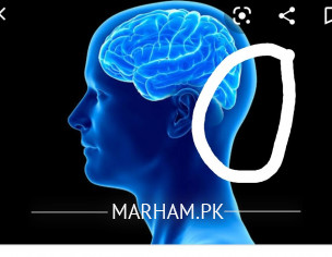 Headache Issue