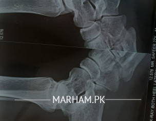 Foot.back Side Pain