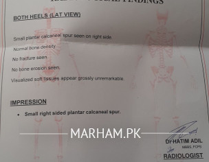 Foot.back Side Pain