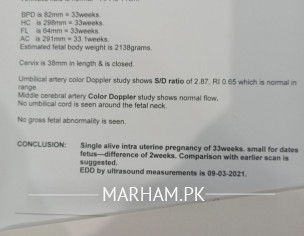 Doppler Scan Study