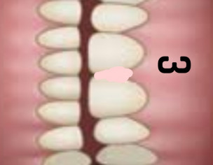 Dental Problem