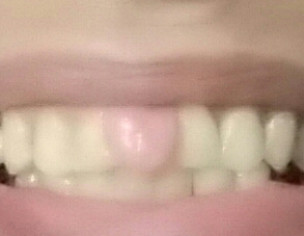 Dental Problem