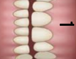 Dental Problem