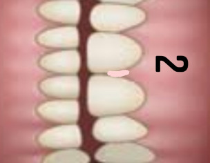 Dental Problem