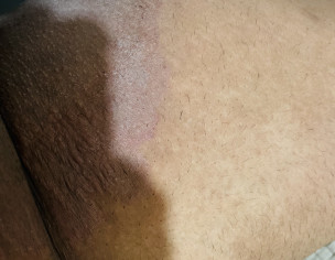 Dermatologist