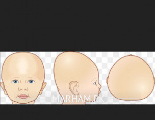 Head Shape