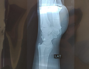 Orthopaedic