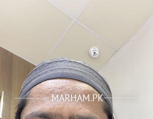Skin Problem