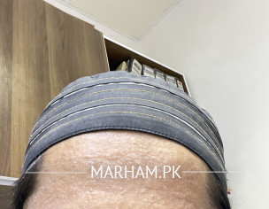 Skin Problem