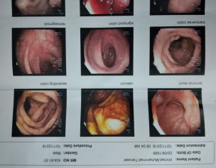 Stomach Disorders