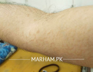 Skin Problem