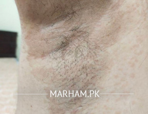 Skin Problem