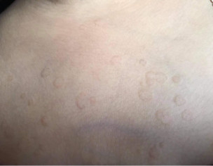 Skin Problem